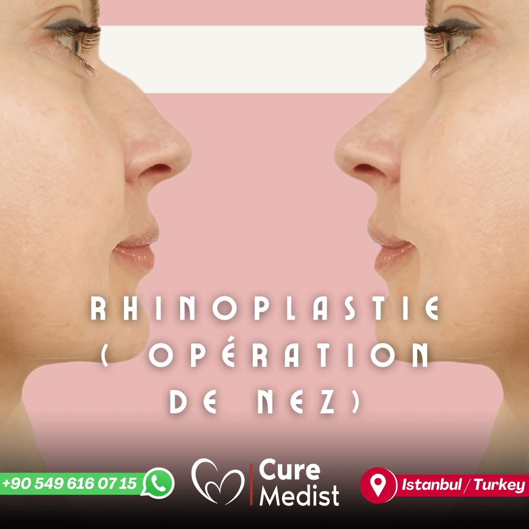 rhinoplasty