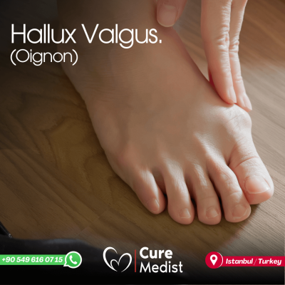 hallux 2